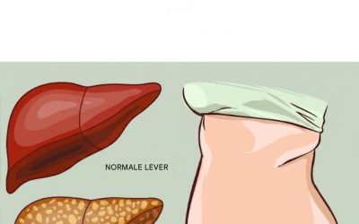 8 voedingsmiddelen die de levergezondheid op natuurlijke wijze kunnen ondersteunen