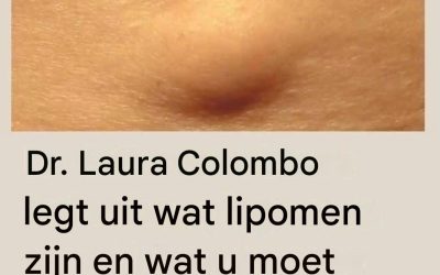 Dr. Laura Colombo legt uit wat lipomen zijn en wat u moet doen als u er een heeft (1 / 2)