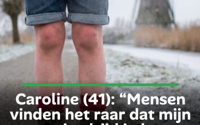Caroline (41): “Mensen vinden het raar dat mijn zoontje altijd in korte broeken loopt, ook in de winter”