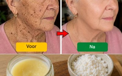 Hoe vaseline een verzachtend effect heeft op huidafwijkingen. HYN