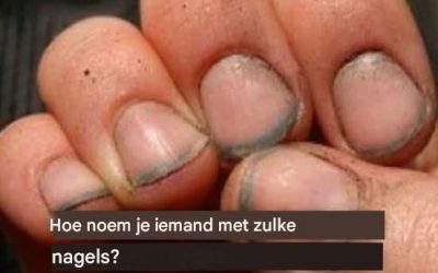 Hoe noem je iemand met zulke nagels?