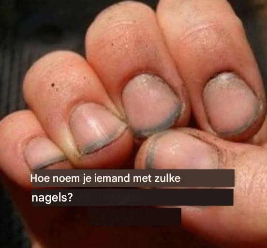 Hoe noem je iemand met zulke nagels?