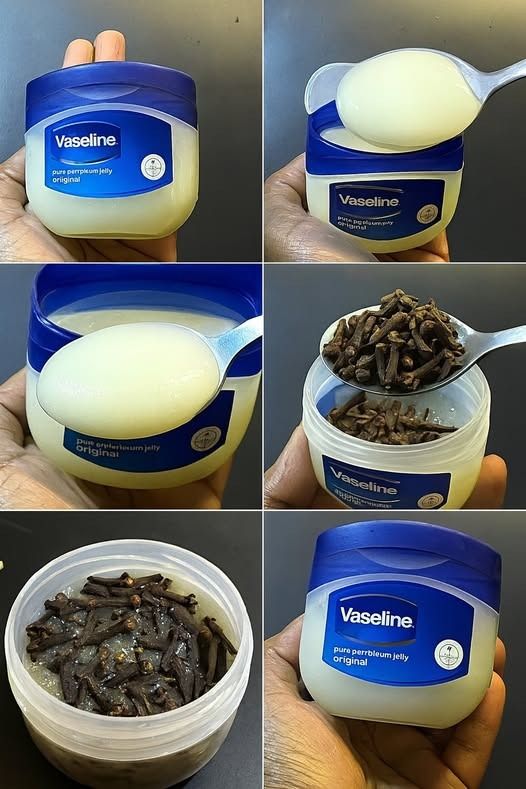 Meng kruidnagel met vaseline: een geheim dat niemand je ooit zal vertellen. Je zult me ​​later dankbaar zijn.