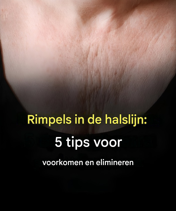 Rimpels op het decolleté: 5 tips om ze te voorkomen en te verwijderen