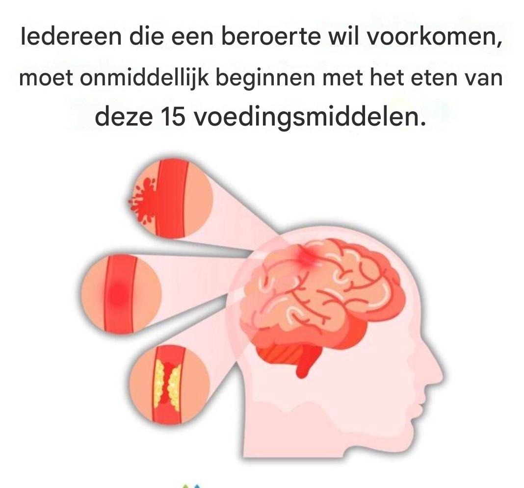 Iedereen die een beroerte wil voorkomen, moet onmiddellijk beginnen met het eten van deze 15 voedingsmiddelen.