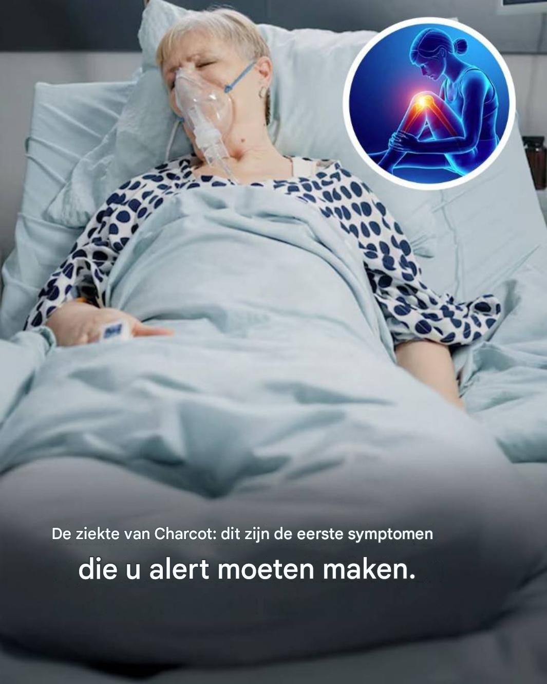 De ziekte van Charcot: dit zijn de eerste symptomen van deze aandoening.