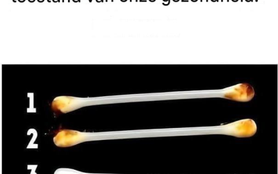 Onze oren verraden de ware toestand van onze gezondheid.
