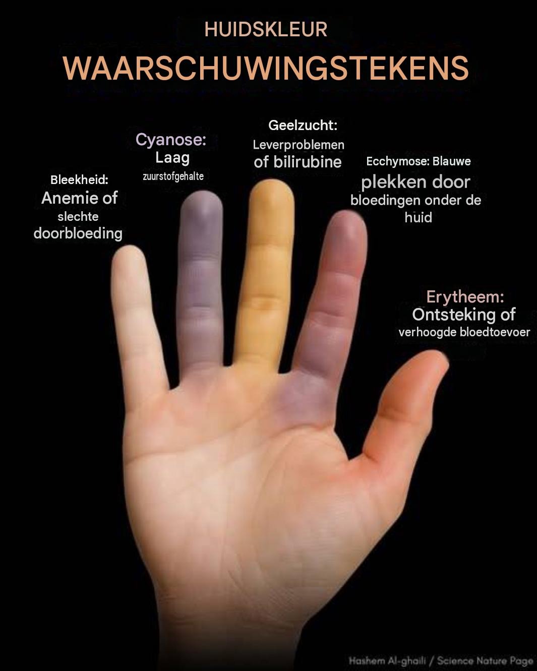 Je huid kan je waarschuwen voor een verborgen gezondheidsprobleem – negeer deze signalen niet.